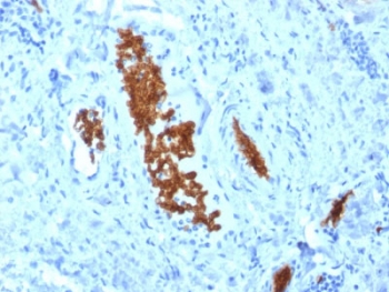 IHC staining of FFPE human tonsil with SPTA