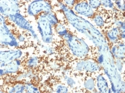 IHC staining of FFPE human placenta with SPTA1 antibody (clone SPTA1/1810). Required HIER: boil tissue sections in pH6, 10mM citrate buffer, for 10-20 min followed by cooling at RT for 20 min.
