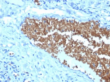 IHC staining of FFPE human tonsil with Spectrin alpha 1 antibody (clone SPTA1/1832). Required HIER: boil tissue sections in pH6, 10mM citrate buffer, for 10-20 min followed by cooling at RT for 20 min.~