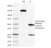 SDS-PAGE analysis of purified, BSA-free Spectrin alpha 1 antibody (clone SPTA1/1832) as confirmation of integrity and purity.