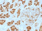 IHC staining of FFPE human kidney with CD10 antibody (clone MME/1893). Required HEIR: boil tissue sections in 10mM Tris with 1mM EDTA, pH 9, for 10-20 min and allow to cool before testing.