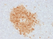 IHC staining of FFPE human tonsil with CD10 antibody (clone MME/1893). Required HEIR: boil tissue sections in 10mM Tris with 1mM EDTA, pH 9, for 10-20 min and allow to cool before testing.