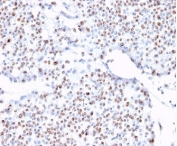 IHC staining of FFPE human bladder with TCF4 antibody (clone TCF4/1705). HIER: boil tissue sections in pH 9 10mM Tris with 1mM EDTA for 20 min and allow to cool before testing.