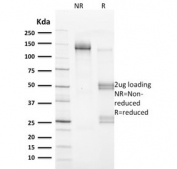 SDS-PAGE analysis of purified, BSA-free Vinculin antibody (clone VCL/2572) as confirmation of integrity and purity.