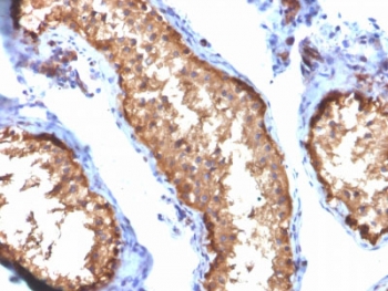 IHC testing of FFPE human testis tissue with Vinculin antibody (clone VCL/2572). HIER: boil tissue sections in pH6, 10mM citrate buffer, for 10-20 min followed by cooling at RT for 20 min.~