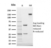 SDS-PAGE analysis of purified, BSA-free StAR antibody (clone STAR/2140) as confirmation of integrity and purity.