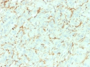 IHC testing of FFPE human adrenal gland with NGF Receptor antibody (clone NGFR/1964). HIER: boil tissue sections in pH6, 10mM citrate buffer, for 10-20 min followed by cooling at RT for 20 min.