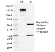 SDS-PAGE analysis of purified, BSA-free NGF Receptor antibody (clone NGFR/1964) as confirmation of integrity and purity.