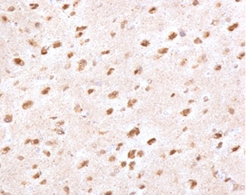 IHC staining of FFPE human brain with Ubiquitin antibody (clone PBQN-1). Required HIER: boil tissue sections in pH 9 10mM Tris with 1mM EDTA for 10-20 min followed by cooling at RT for 20 min.~