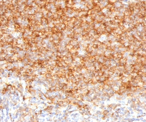 IHC testing of human tonsil with CD40 antibody (clone CDLA40-1). Required HIER: boil tissue sections in 10mM citrate buffer, pH 6, for 10-20 min.~