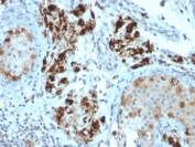 IHC staining of FFPE human adrenal gland with StAR antibody (clone STAR/2154). Required HIER: boil tissue sections in pH 9 10mM Tris with 1mM EDTA for 10-20 min followed by cooling at RT for 20 min.