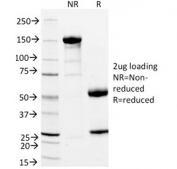 SDS-PAGE analysis of purified, BSA-free StAR antibody (clone STAR/2154) as confirmation of integrity and purity.