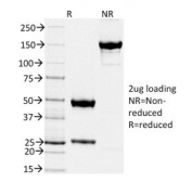 SDS-PAGE analysis of purified, BSA-free TIMP2 antibody (clone TIMP2/2044) as confirmation of integrity and purity.
