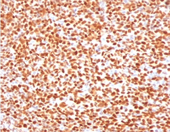 IHC testing of FFPE human tonsil with OCT-2 antibody (clone PD2F2-1). HIER: boil tissue sections in pH 9 10mM Tris with 1mM EDTA for 10-20 min followed by cooling at RT for 20 min.~