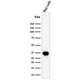 Western blot testing of human Raji cell lysate with BOB1 antibody (clone BOB1/2425). Predicted molecular weight: ~28 kDa (unmodified), 35-40 kDa (ubiquitinated).~
