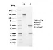 SDS-PAGE analysis of purified, BSA-free Perforin antibody (clone PRF1/2470) as confirmation of integrity and purity.