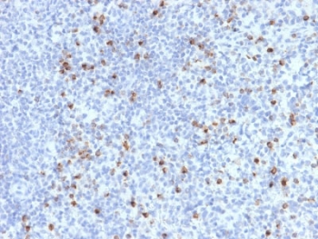 IHC testing of FFPE human spleen with Perforin antibody (clone PRF1/2470). HIER: boil tissue sections in pH6, 10mM citrate buffer, for 10-20 min followed by cooling at RT for 20 min.~