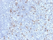 IHC testing of FFPE human spleen with Perforin antibody (clone PRF1/2470). HIER: boil tissue sections in pH6, 10mM citrate buffer, for 10-20 min followed by cooling at RT for 20 min.