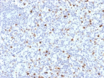 IHC testing of FFPE human spleen with Perforin antibody (clone PRF1/2468). HIER: boil tissue sections in pH6, 10mM citrate buffer, for 10-20 min followed by cooling at RT for 20 min.~