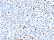 IHC testing of FFPE human spleen with Perforin antibody (clone PRF1/2468). HIER: boil tissue sections in pH6, 10mM citrate buffer, for 10-20 min followed by cooling at RT for 20 min.