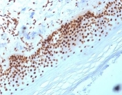 IHC testing of FFPE human skin with Nucleophosmin antibody (clone NA24). HIER: boil tissue sections in pH6, 10mM citrate buffer, for 10-20 min followed by cooling at RT for 20 min.