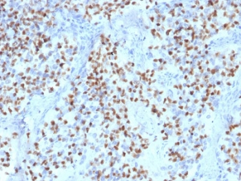 IHC testing of FFPE human lymph node with OCT-2 antibody (clone OCT2/2136). HIER: boil tissue sections in pH6, 10mM citrate buffer, for 10-20 min followed by cooling at RT for 20 min.~