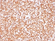 IHC testing of FFPE human tonsil with OCT-2 antibody (clone OCT2/2137). HIER: boil tissue sections in pH 9 10mM Tris with 1mM EDTA for 10-20 min followed by cooling at RT for 20 min.