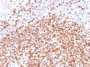 IHC testing of FFPE human lymph node with OCT-2 antibody (clone OCT2/2137). HIER: boil tissue sections in pH 9 10mM Tris with 1mM EDTA for 10-20 min followed by cooling at RT for 20 min.