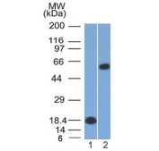 Western blot testing of 1) partial recombinant protein and 2) human Daudi lysate with OCT-2 antibody (clone OCT2/2137). Expected molecular weight: isoforms from 43~62 kDa.