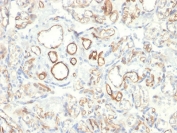 IHC testing of FFPE human placenta with Podocalyxin antibody (clone PODXL/2185). HIER: boil tissue sections in pH6, 10mM citrate buffer, for 10-20 min followed by cooling at RT for 20 min.