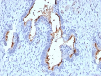IHC testing of FFPE human endometrium with Podocalyxin antibody (clone PODXL/2185). HIER: boil tissue sections in pH6, 10mM citrate buffer, for 10-20 min followed by cooling at RT for 20 min.~