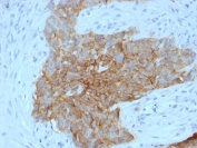 IHC testing of human tongue with GLUT1 antibody (clone GLUT1/2475). Required HIER: boil tissue sections in pH 9 10mM Tris with 1mM EDTA for 10-20 min followed by cooling at RT for 20 min.