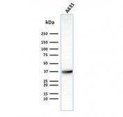 Western blot testing of human A431 cells with GLUT1 antibody (clone GLUT1/2475). Expected molecular weight: 45-55 kDa.