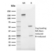 SDS-PAGE analysis of purified, BSA-free GLUT1 antibody (clone GLUT1/2475) as confirmation of integrity and purity.