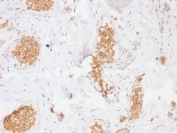 IHC testing of human bladder with GLUT1 antibody (clone GLUT1/2476). Required HIER: boil tissue sections in pH 9 10mM Tris with 1mM EDTA for 10-20 min followed by cooling at RT for 20 min.