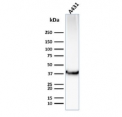 Western blot testing of human A431 cells with GLUT1 antibody (clone GLUT1/2476). Expected molecular weight: 45-55 kDa.
