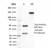 SDS-PAGE analysis of purified, BSA-free PTEN antibody (clone PTEN/2110) as confirmation of integrity and purity.