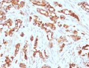 IHC testing of FFPE human prostate tissue with AURKB antibody (clone ARRK2-1). HIER: boil tissue sections in pH6, 10mM citrate buffer, for 10-20 min followed by cooling at RT for 20 min.