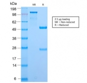 SDS-PAGE analysis of purified, BSA-free BrdU antibody (clone BRD2888R) as confirmation of integrity and purity.