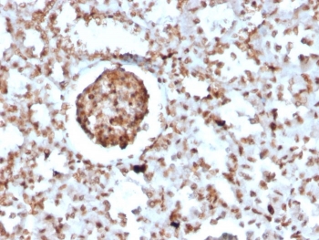 IHC staining of BrdU-incorporated FFPE mouse kidney with BrdU antibody (clone BRD2888R). HIER: boil tissue sections in pH 9 10mM Tris with 1mM EDTA for 20 min and allow to cool before testing.~