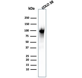 Western blot testing of human COLO-38 cell lysate with PMEL17 antibody (clone PMEL/2039).