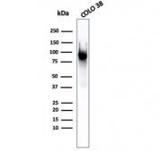 Western blot testing of human COLO-38 cell lysate with PMEL17 antibody (clone PMEL/2037).