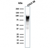 Western blot testing of human COLO-38 cell lysate with Melanoma gp100 antibody (clone PMEL/2038).