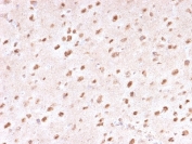 IHC staining of FFPE human brain with Ubiquitin antibody (clone UBB/1748). Required HIER: boil tissue sections in 10mM citrate buffer, pH 6, for 10-20 min followed by cooling at RT for 20 min.