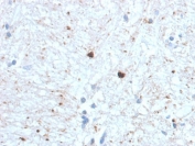 IHC staining of FFPE human brain with Ubiquitin antibody (clone UBB/1748). Required HIER: boil tissue sections in 10mM citrate buffer, pH 6, for 10-20 min followed by cooling at RT for 20 min.