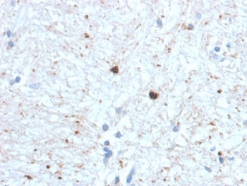 IHC staining of FFPE human brain with Ubiquitin antibody (clone UBB/1748). Required HIER: boil tissue sections in 10mM citrate buffer, pH 6, for 10-20 min followed by cooling at RT for 20 min.