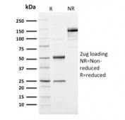 SDS-PAGE analysis of purified, BSA-free Ubiquitin antibody (clone UBB/1748) as confirmation of integrity and purity.