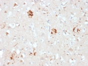 IHC staining of FFPE human brain with Ubiquitin antibody (clone UBB/2122). Required HIER: boil tissue sections in pH 9 10mM Tris with 1mM EDTA for 10-20 min followed by cooling at RT for 20 min.