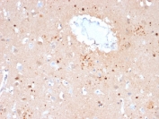 IHC staining of FFPE human brain with Ubiquitin antibody (clone UBB/2122). Required HIER: boil tissue sections in pH 9 10mM Tris with 1mM EDTA for 10-20 min followed by cooling at RT for 20 min.