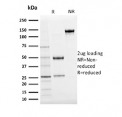 SDS-PAGE analysis of purified, BSA-free Ubiquitin antibody (clone UBB/2122) as confirmation of integrity and purity.